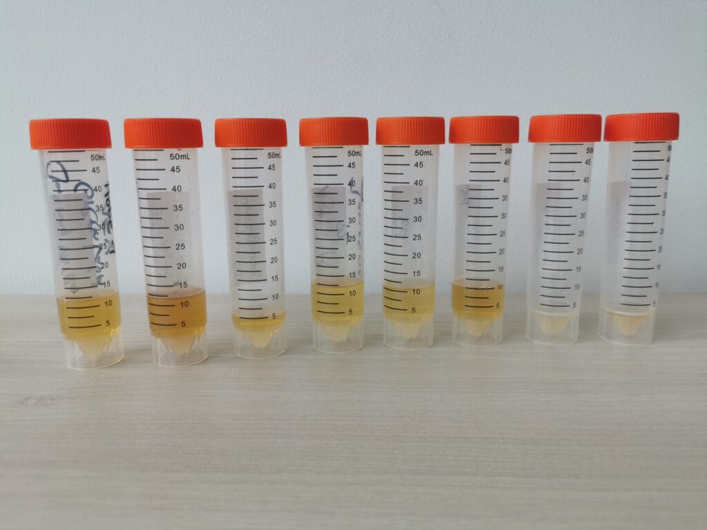 Aufreihung von 50 milliliter Sarstedt-Röhrchen, gefüllt mit verschiedenen, gelblichen Flüssigkeiten